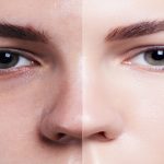 cosmetic surgery
